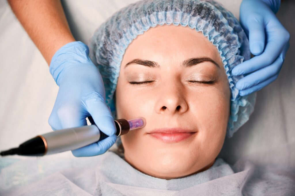 The Revitapen Facial Treatment Is A Non-Invasive Way To Treat Many Skin Ailments. 