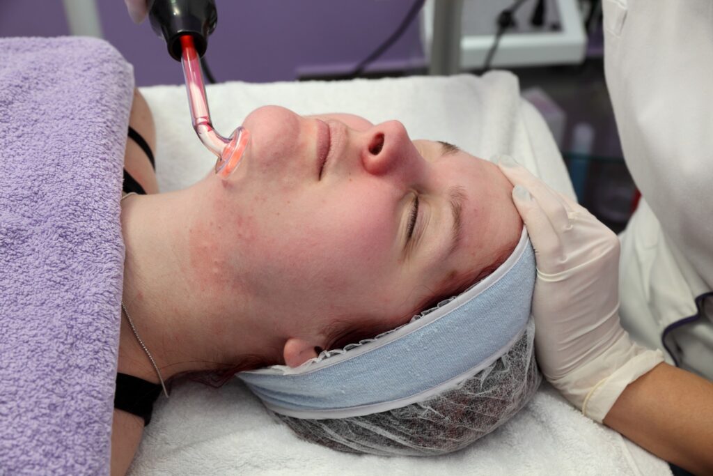 Can Facials Help With Hormonal Acne? Yes They Can! Image Of Person Receiving A High Frequency Facial Treatment For Acne.